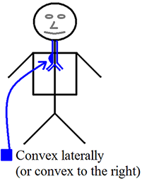 Convex laterally