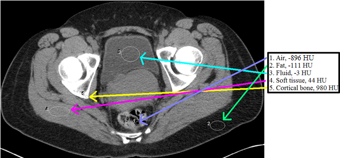 CT Densities