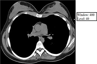 Window and Level
